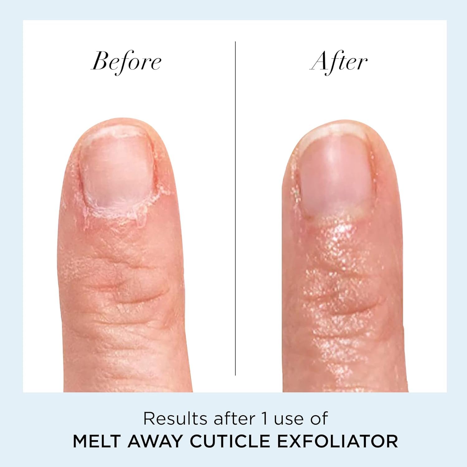 butter LONDON Cuticle Remover Liquid, Melt Away - Cuticle Softener Oil Exfoliator Gently Removes Dry & Overgrown Skin - Nail Care for Clean & Healthy-Looking Nails, Home Manicure & Pedicure - Image 4